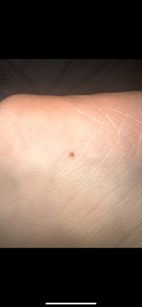 Moles
