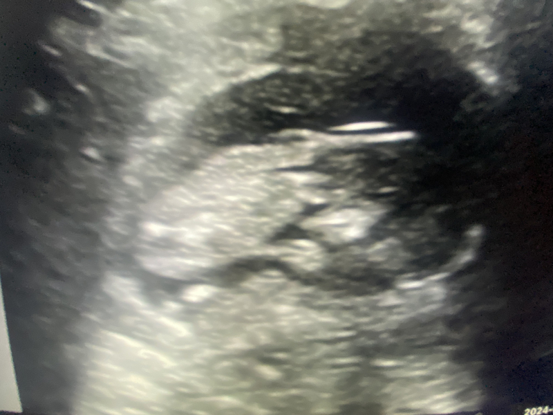 Nub theory pros, is this definitely a boy…?