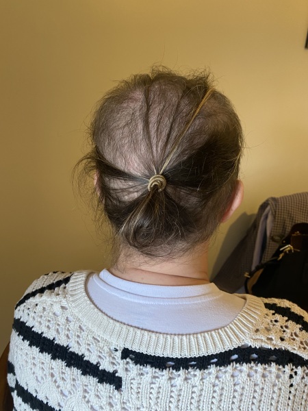 Cancer Support Thread 96: It’s nearly Christmas - get the sprouts on.