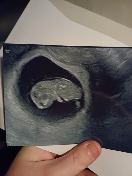 11DPO positive - but concerned