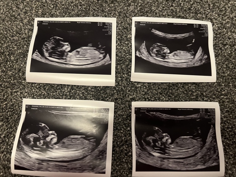12weeks 6 days Nub Theory guesses