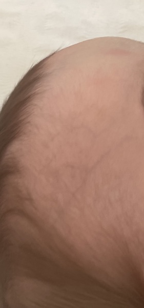 Veins on babies head??