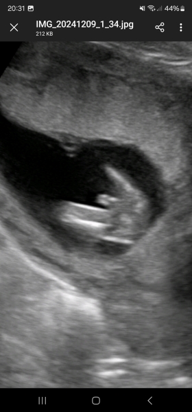 Boy or girl