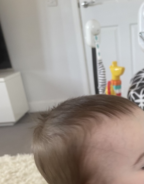 Veins on babies head??