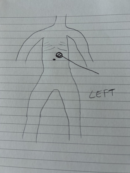 What is this in this part of the abdomen?