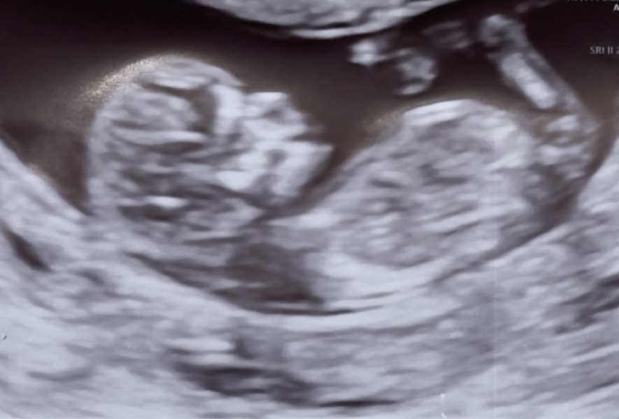 Any guesses for the sex!?