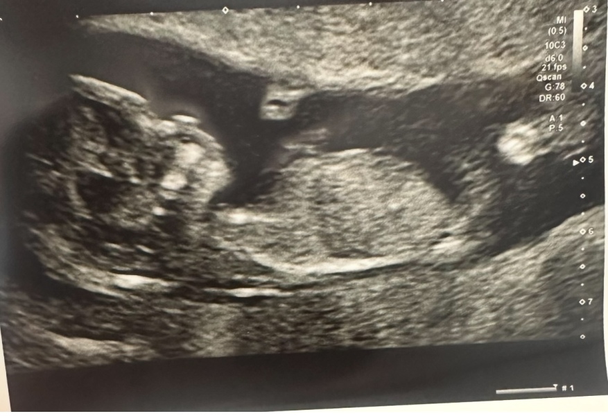 Boy or girl?