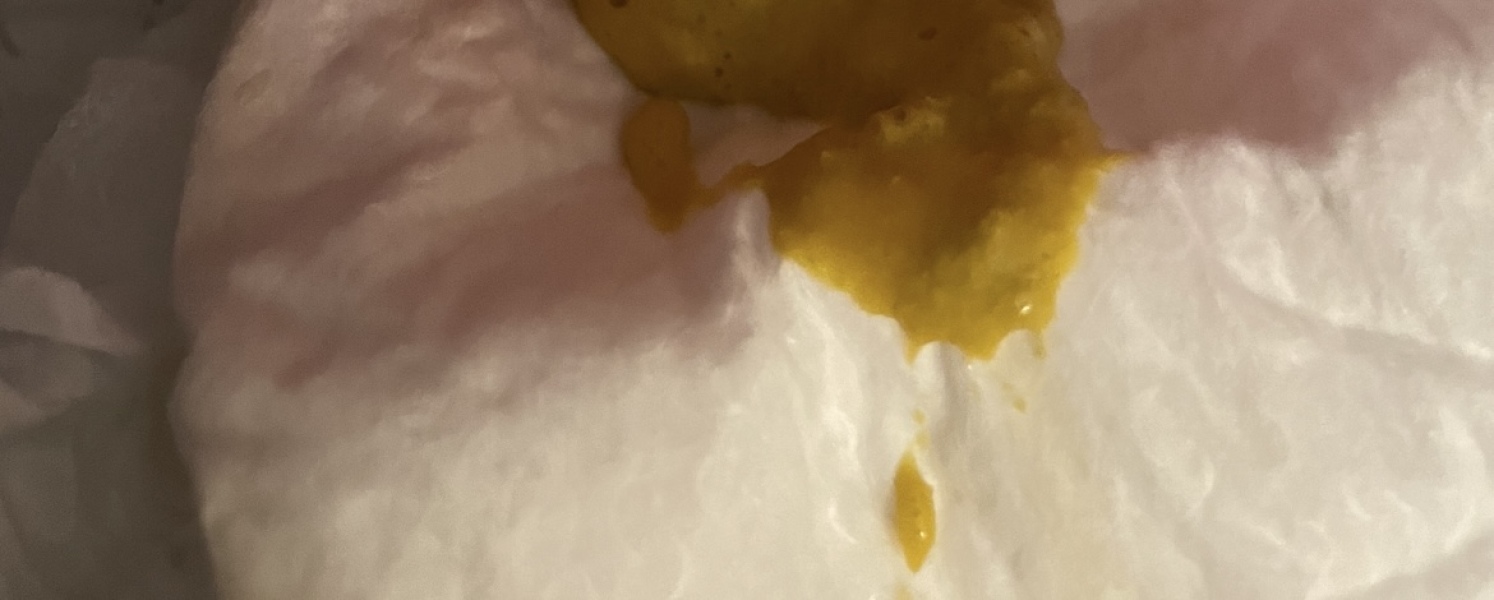 CMPA or is this normal?