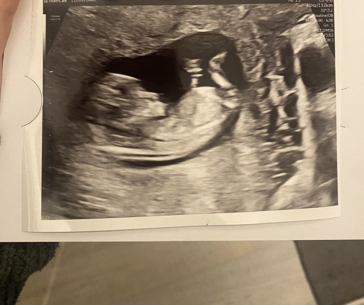 My baby seems to be lacking a nub