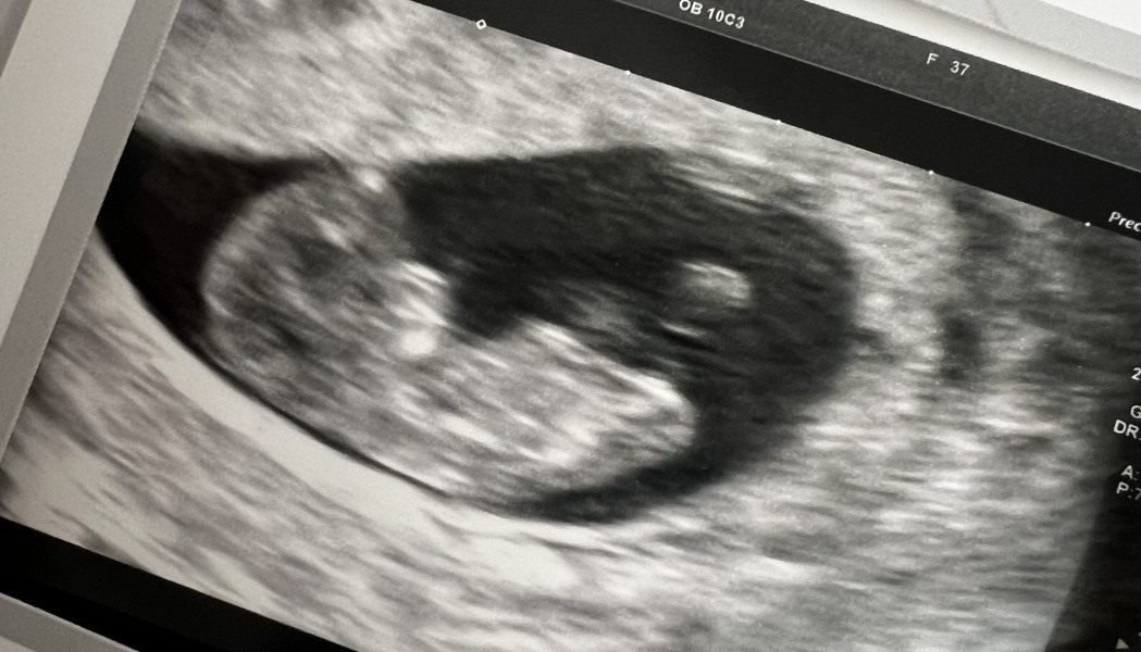 Boy or girl