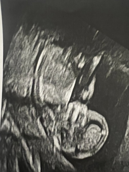 Boy or girl?