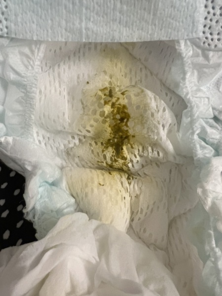 Green poo