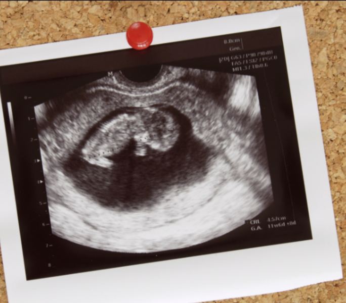 Does all your antenatal Printed scan have information on it?