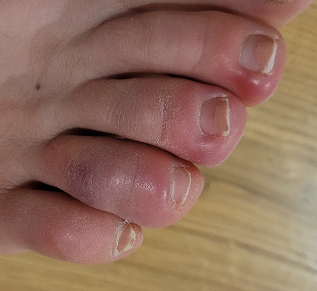 Please help my feet