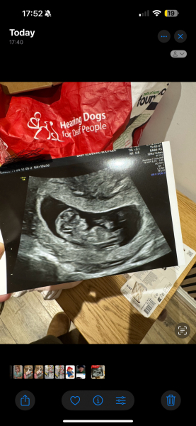 11DPO positive - but concerned