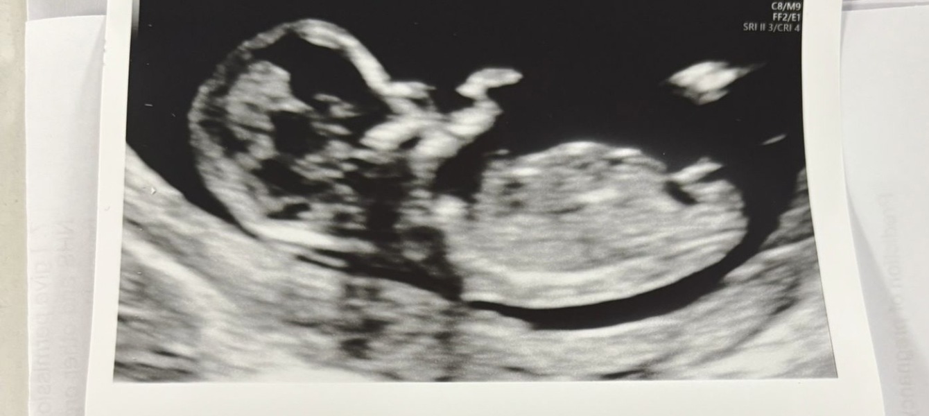 Nub theory gender guesses