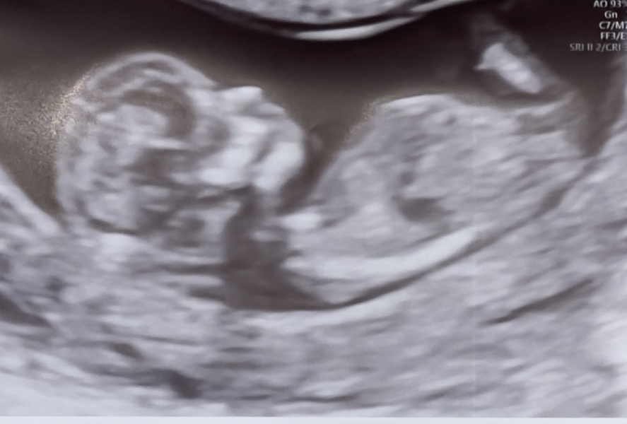 Any guesses for the sex!?