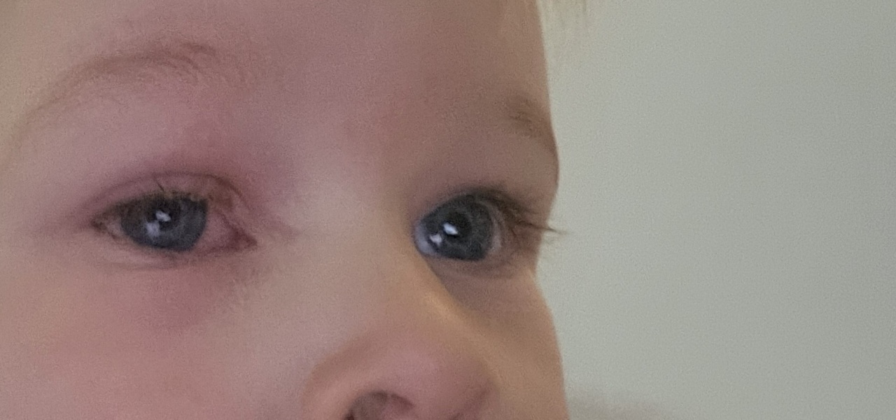 Pharmacist or GP????