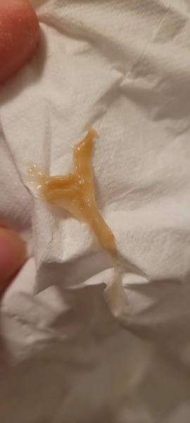 Is this viral? (WARNING DISGUSTING PHELGM PIC)