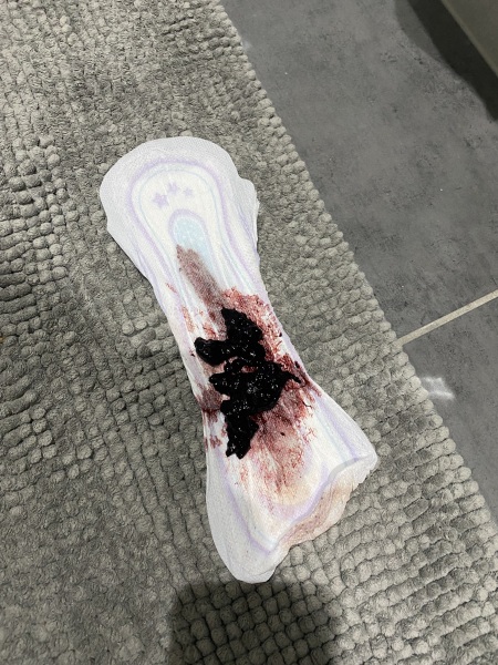 Normal / GP / walk in or A&E - MMC Trigger Warning