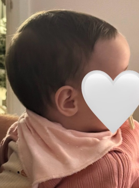 Baby head shape