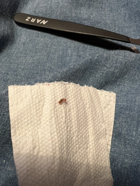 Lovely little maggot I've just dug from DP face