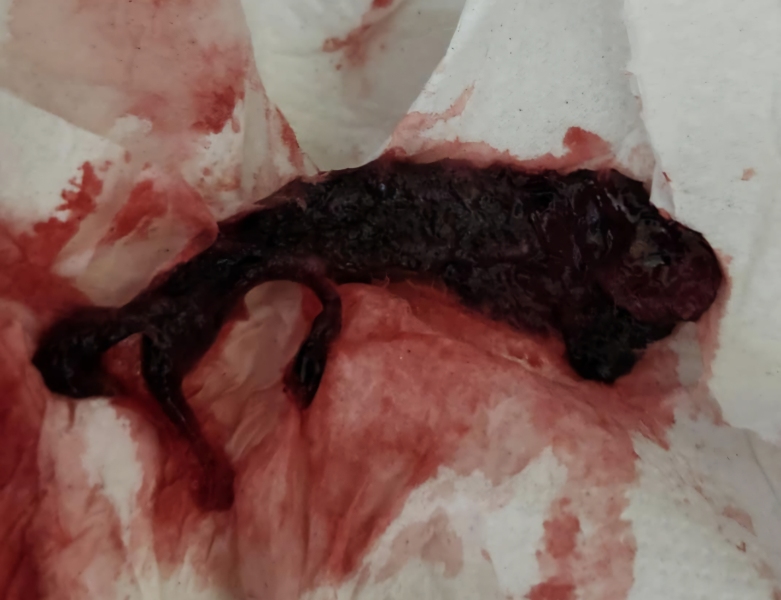 Is this a miscarriage