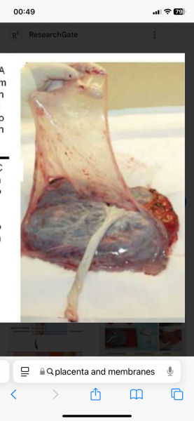 Random question about the amniotic sac