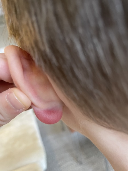 Swelling on ds4’s ear — any ideas?