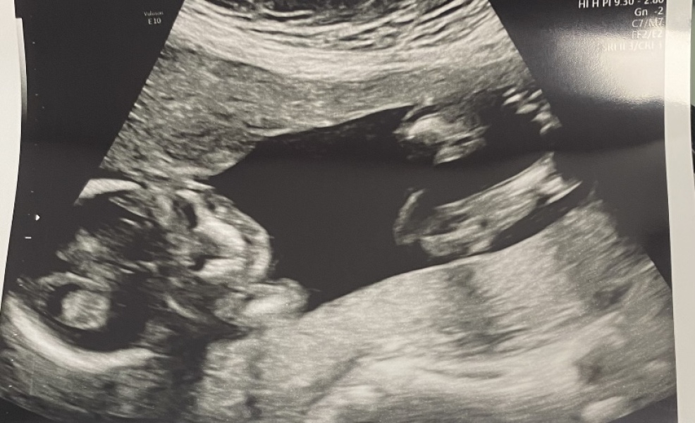Gender guesses
