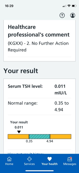 Would someone look at my TSH result please