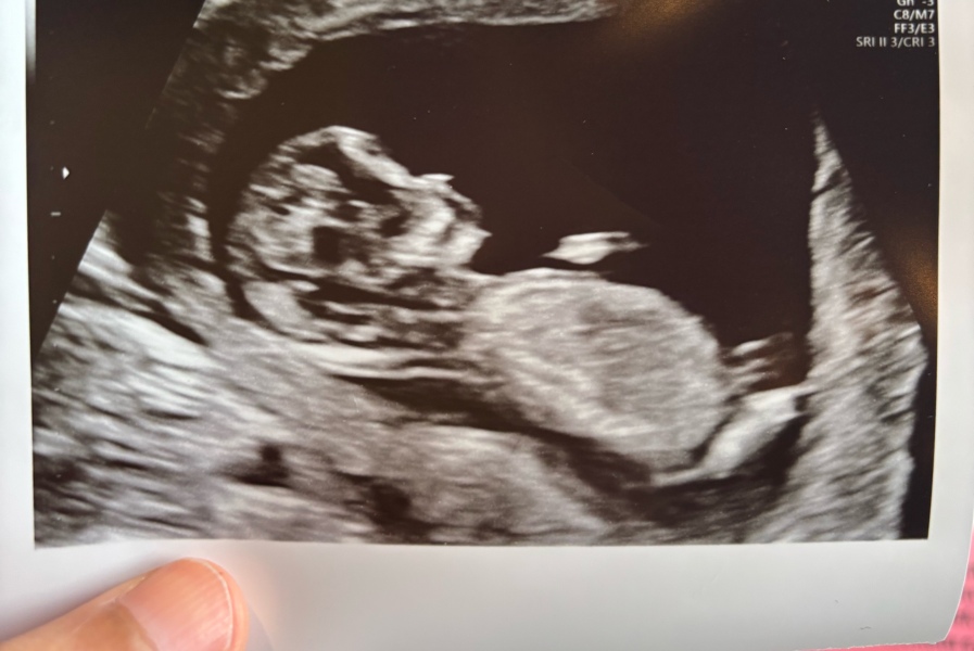 Gender guesses!