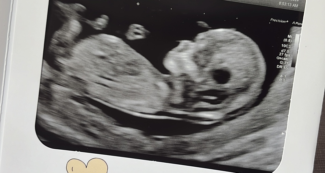 Boy or girl? Nun theory