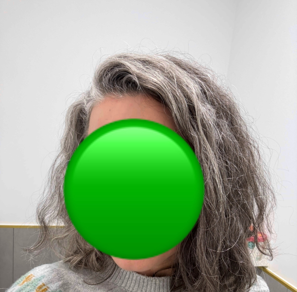 Help me look better please! Early/mid 40s 🙏🏻