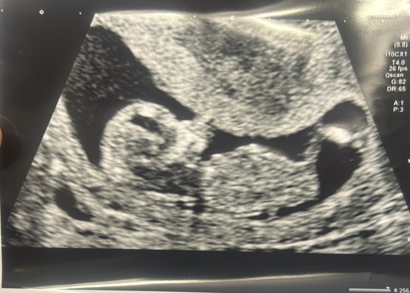 Gender Guess