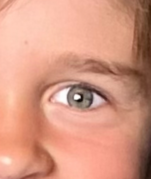 Brown band in my newborn eyes (picture included )