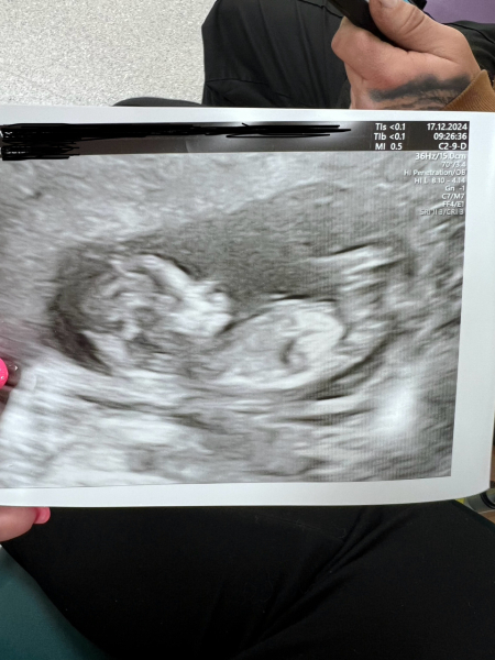 Due July 25 - Thread 2 - Approaching the 12 week scans!