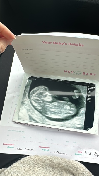 4 weeks 6 days, due 9 July 2024.. anyone wanna join?