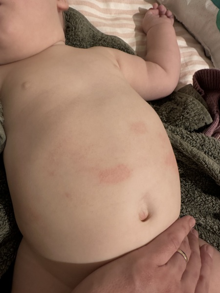 Dairy / Gluten Intolerance. Any advice / experience appreciated