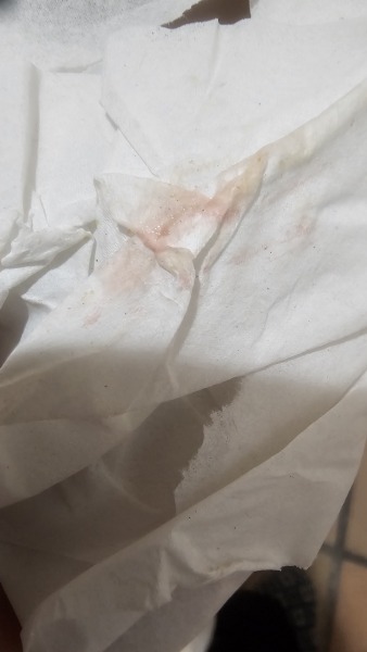 Is this implantation bleeding *trigger warning*