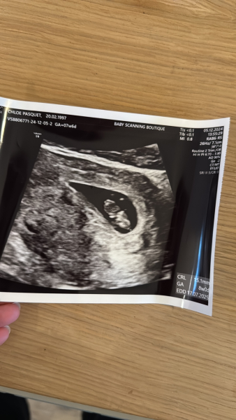 11DPO positive - but concerned