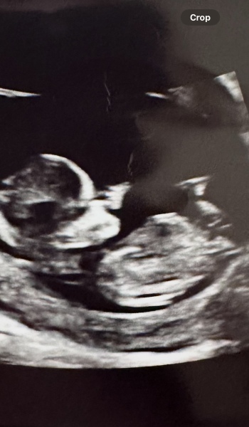 Gender guess please?!