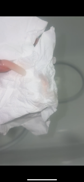 Implantation Bleeding?
