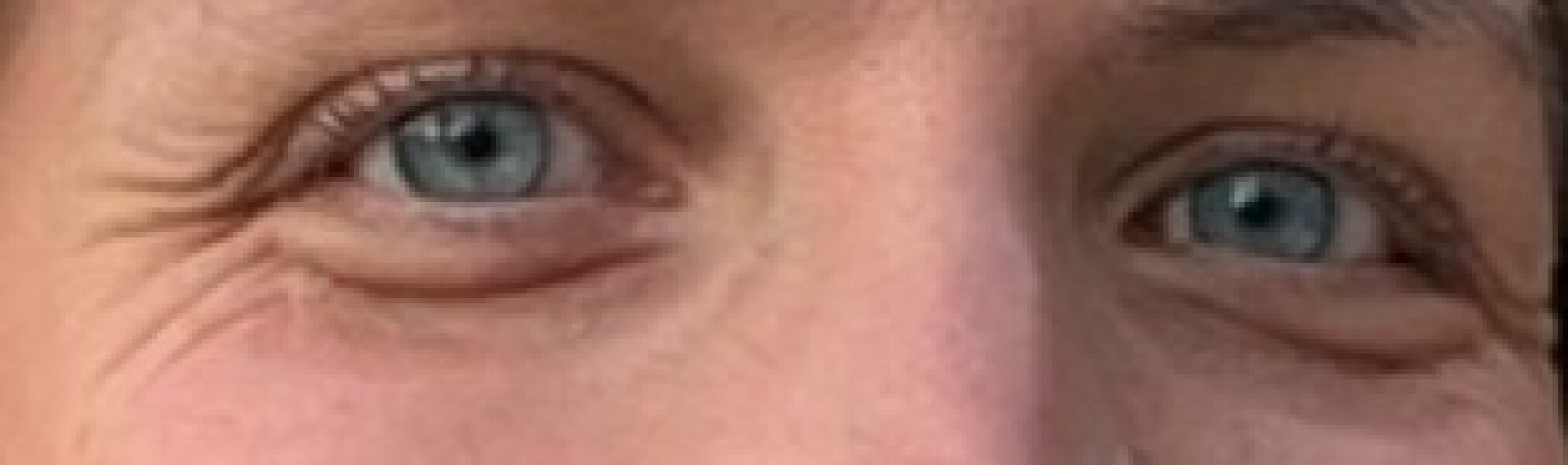 OMG help - my eyes!!