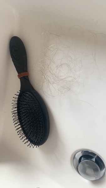 How much hair do you lose (picture)?