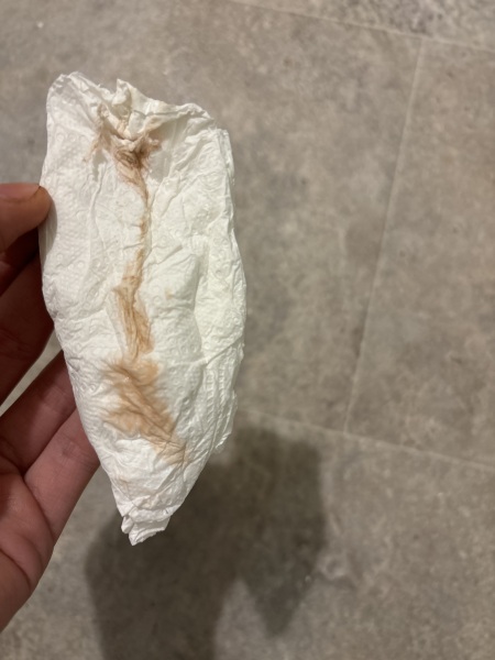 Am I pregnant or not?
