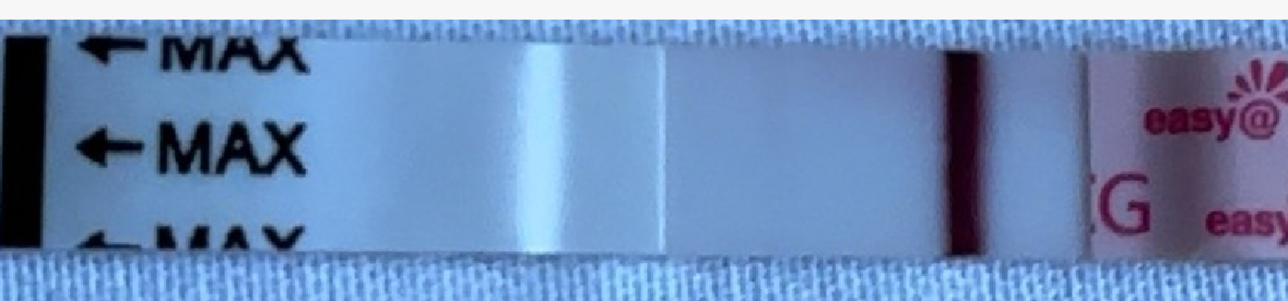 Faint line or indent or nothing