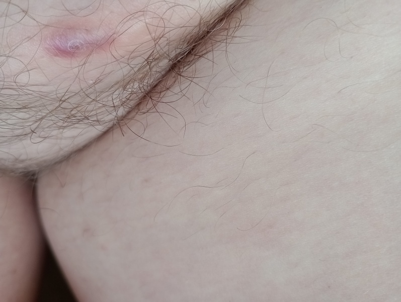 WTF is this on my foof?!