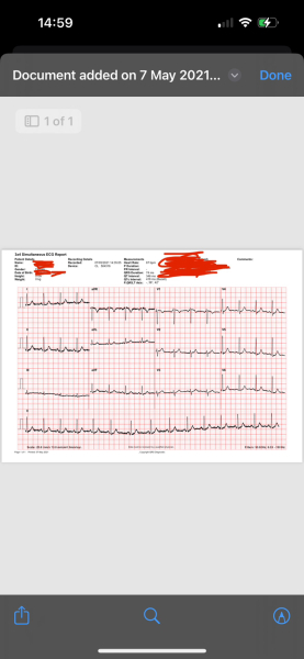 ECG interpretation