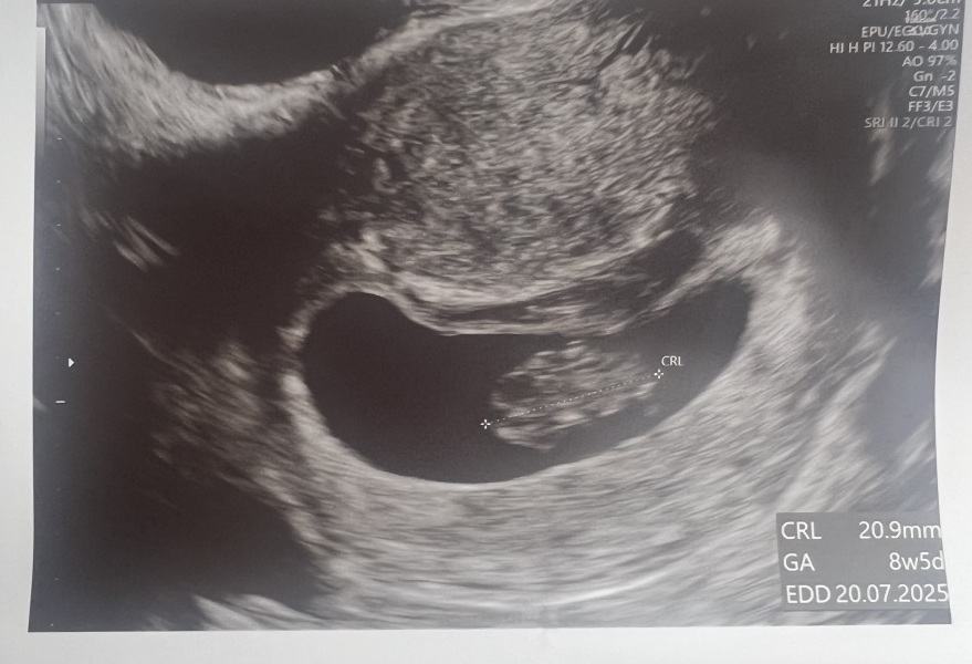 11DPO positive - but concerned